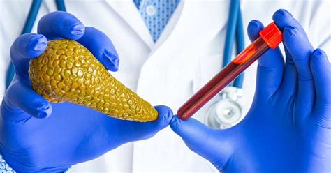 Lipase Test