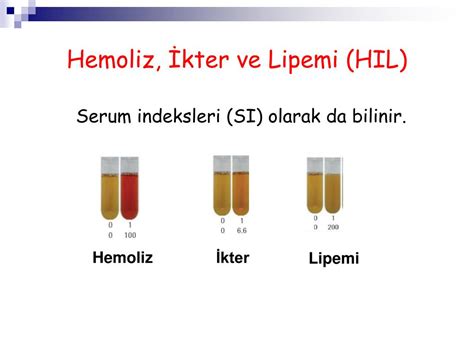 Lipemik ikterik hemoliz 0 Alet.