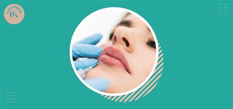 Lipfillers - Kliniek Laurium