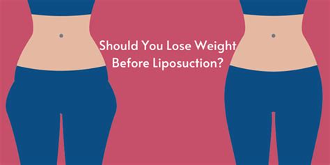 Liposuction Surgery - When You Should Be Concerned