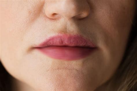 Cold sores, or herpes simplex, are also called "fever blisters.". People frequently experience tingling or itch before the small blisters of a cold sore come out. Herpes is a recurring viral infection. Inside the mouth, persistent white lesions can be concerning. Oral lichen planus is a benign condition of the inside cheeks, lips, or tongue.. 