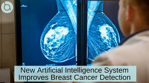 Lisa Jarvis: AI improves breast cancer detection. But will that save lives?