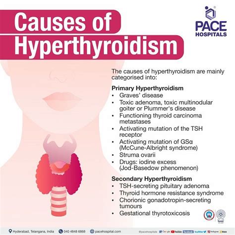 Lithium can cause hyperthyroidism as well as hypothyroidism: A