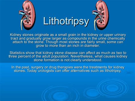 Lithotrypsy - SlideShare