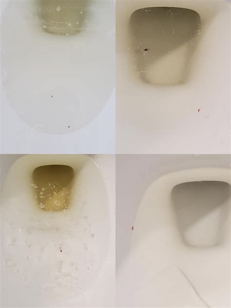 Little specks in urine. Affected dogs will show other signs such as elevated temperature, panting, dry gums, drunk-like gait, high heart rate, seizures, black tarry diarrhea, trouble breathing and collapse. 3. A Bladder Problem. At times, blood in a dog's urine ( hematuria) may cause the urine to assume a brown, reddish tint. 