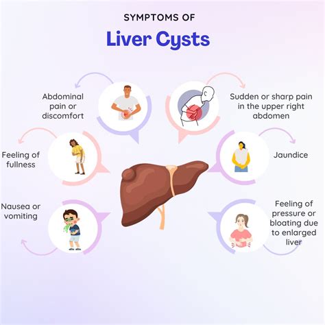 Liver Cyst: Symptoms, Treatments, and Causes