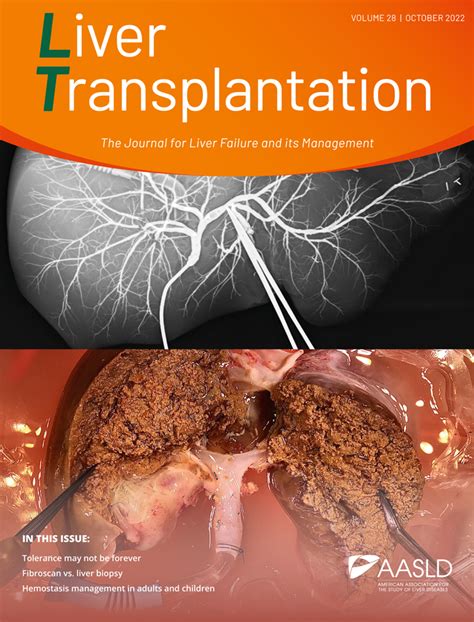 Liver Transplantation - AASLD Journals - Wiley Online …