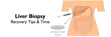 Liver biopsy recovery Time process and position