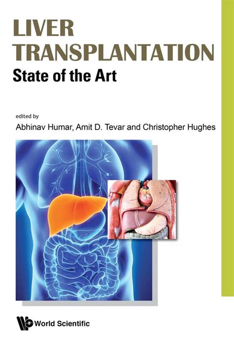 Read Liver Transplantation State Of The Art By Abhinav Humar