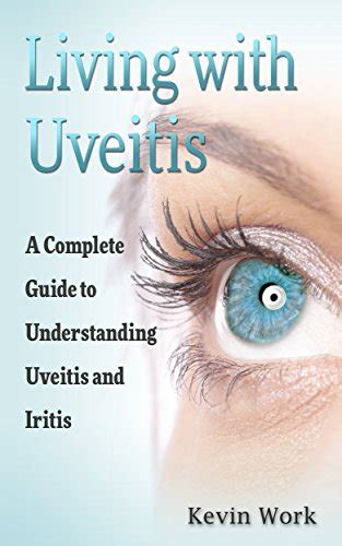 Living with uveitis a complete guide to uveitis and iritis. - Dans le maquis de la presse..