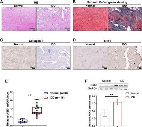 LncRNA TRPC7-AS1 regulates nucleus pulposus cellular …