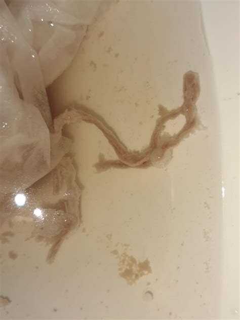 Long brown stringy thing in poop. Shahrivar 30, 1397 AP ... White stringy poop is a symptom of either internal worms and or internal parasites; brown stringy poop is usually just some sort of stomach ... 