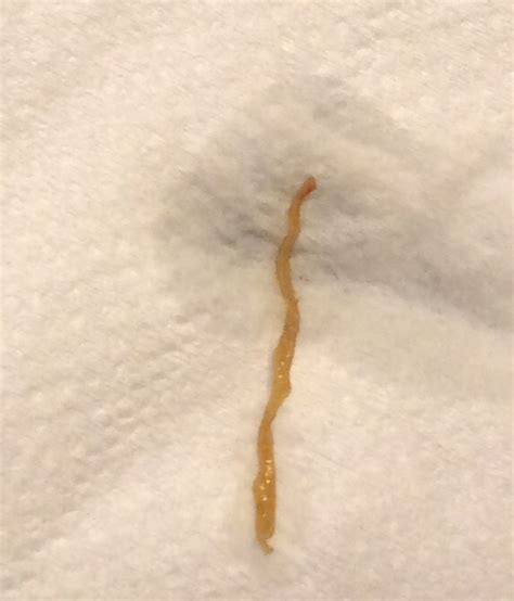 Long mucus string in stool. Things To Know About Long mucus string in stool. 