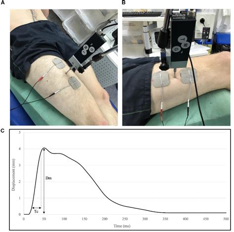 Long-term stability of tensiomyography measured under ... - PubMed