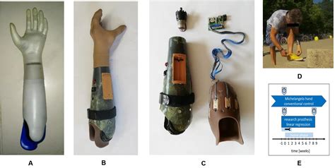 Longitudinal Case Study of Regression-Based Hand Prosthesis …