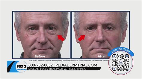 Look your best with Plexaderm – only $14.95 with free shipping