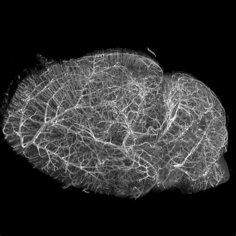 Looking Deep Into Chemically Cleared Brain & Thick Tissues