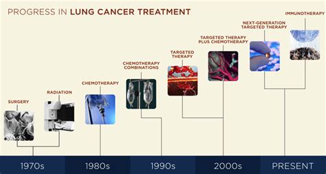 Looking at lung cancer evolution to help improve treatments