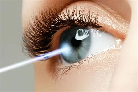 Los Angeles LASIK Surgery Trusted LASIK Surgeons