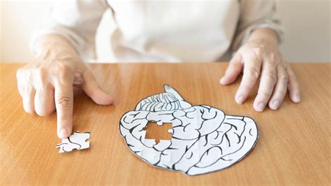 Los hispanos tienen “un riesgo desproporcionadamente mayor” de desarrollar alzhéimer frente a los estadounidenses blancos, revela informe