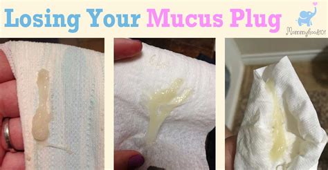 Lost mucus plug at 27 weeks. Around 1 to 2 weeks prior to whelping day, but in some cases, just days or hours prior to whelping, pregnant dogs may have a stringy, whitish discharge. This discharge is often sign that the pregnant dog has lost her mucus plug. 