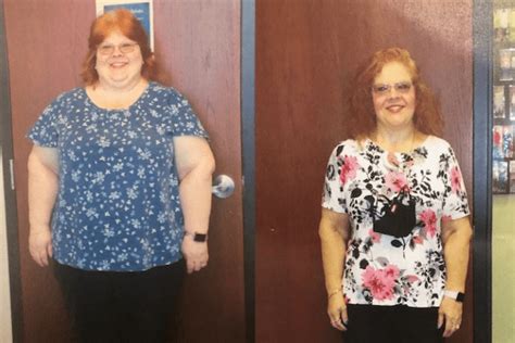 Lourdes Weight-Loss Surgery Ascension