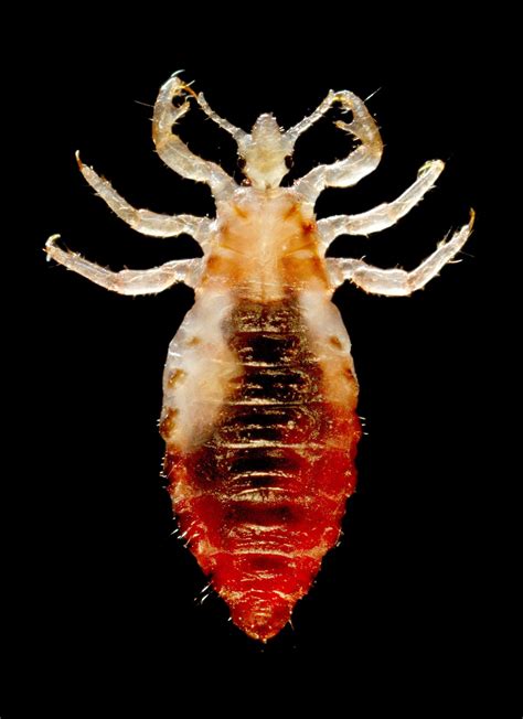 Louse - Wikipedia