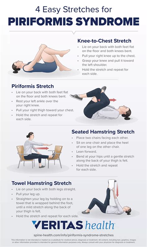 Lower back pain: Piriformis Syndrome - ahap.co.nz