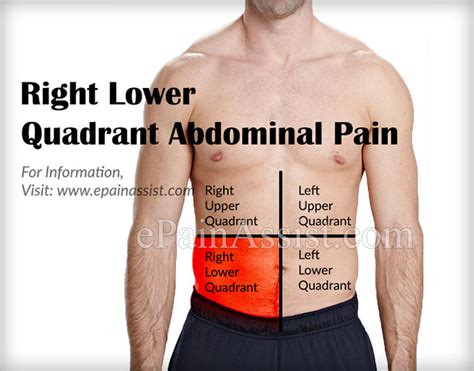 Lower right abdomen fluttering. Some common causes of lower left abdominal pain include irritable bowel syndrome, kidney stones, diverticulitis, and ovarian cysts. Identifying the specific cause of your lower left abdominal pain ... 