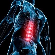 Lumbar (Low Back) Implants Stabilize the Spine - SpineUniverse