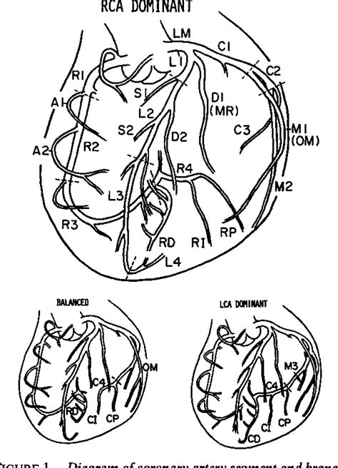 Lumen diameter of normal human coronary arteries. Influence of ... - PubMed