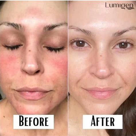 🍑 Lumigen Onlyfans Leak PORN