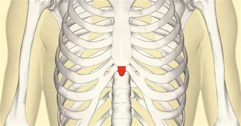 Costochondritis is an inflammation of the cartilage in the