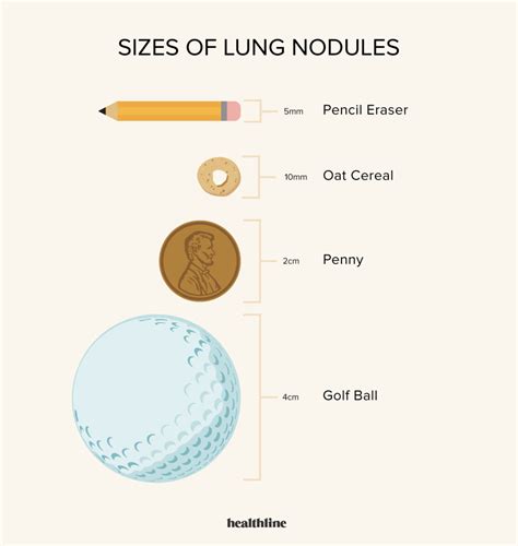 Lung Nodule Size Chart What the Size of Nodules Indicates