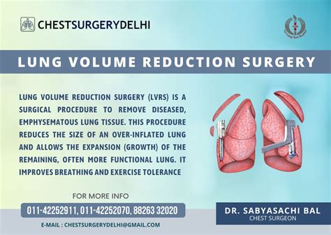 Lung Volume Reduction Surgery Clinical Trials - Mayo Clinic …