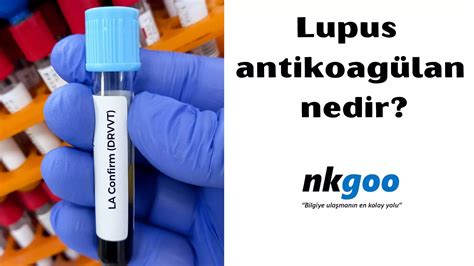 Lupus antikoagülan yüksekliği nedir