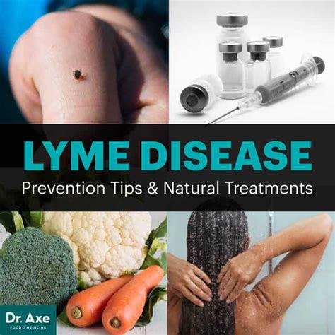 Lyme Disease treatment near Topsham, ME WebMD