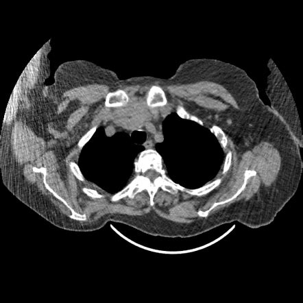 Lymph node imaging Radiology Reference Article