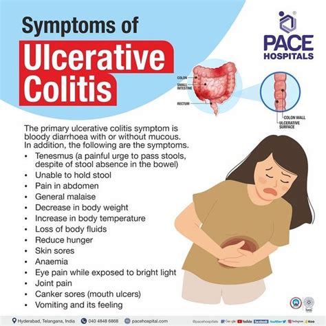 Lymphocytic Colitis Symptoms, Signs & Causes - MedicineNet