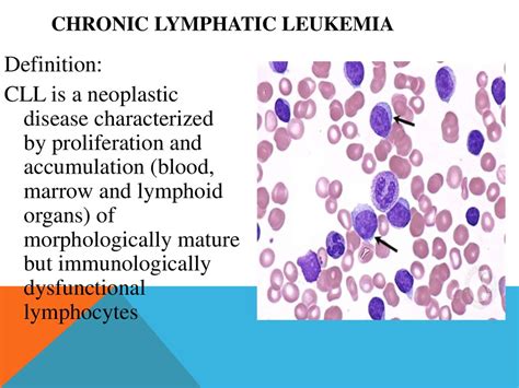 Lymphocytic Definition & Meaning YourDictionary