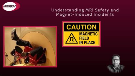 Magnetic Field Risks In Mri Scans - wintechmobiles.com