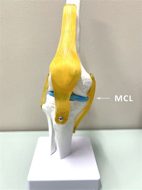 MCL