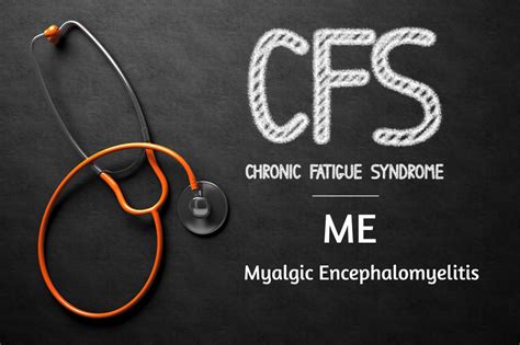 ME/Chronic Fatigue Syndrome Service - Royal Devon …