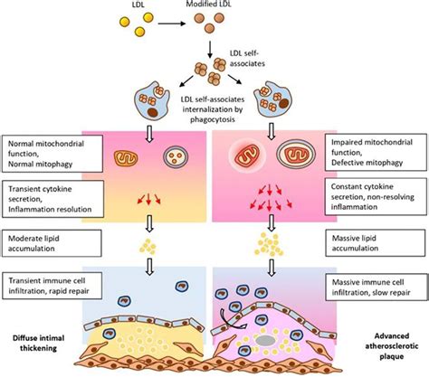 MECHANISMS OF ATHEROSCLEROSIS DEVELOPMENT