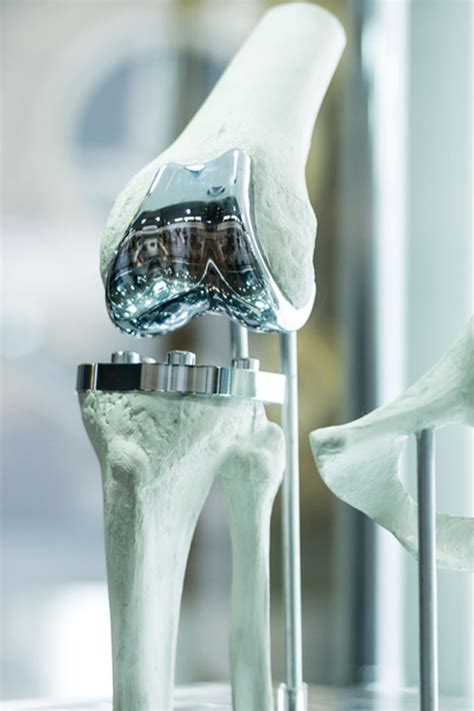 Medical Casting & Orthopaedic Casting Supplies - muktibox.com