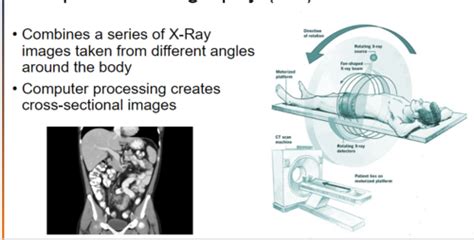 Medical Imaging Flashcards & Quizzes – Page 17 - Brainscape - wintechmobiles.com