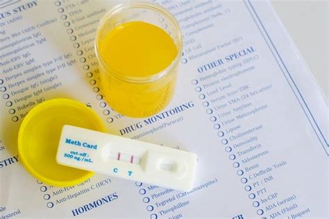 Mengakali Tes Urine Narkoba - Rumah Cemara - wintechmobiles.com