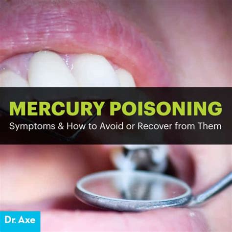 Mercury poisoning - wintechmobiles.com