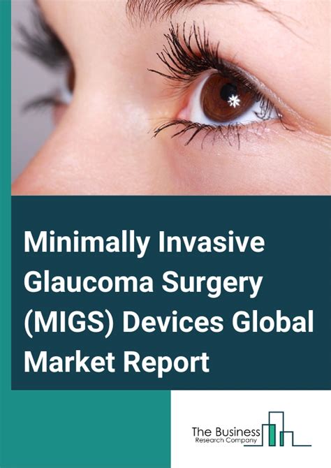 MIGS Minimally Invasive Surgery - Glaucoma UK