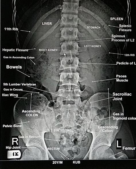 Mobile Abdominal X-Ray - coolestguyplanet.net